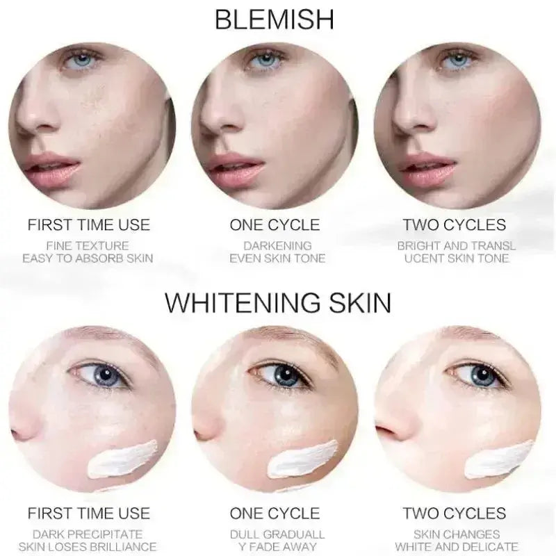 💎 EBUG Ultimate Dark Spot & Pigmentation Fading Set (5 Pcs) - 5pcs