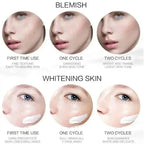 💎 EBUG Ultimate Dark Spot & Pigmentation Fading Set (5 Pcs) - 5pcs