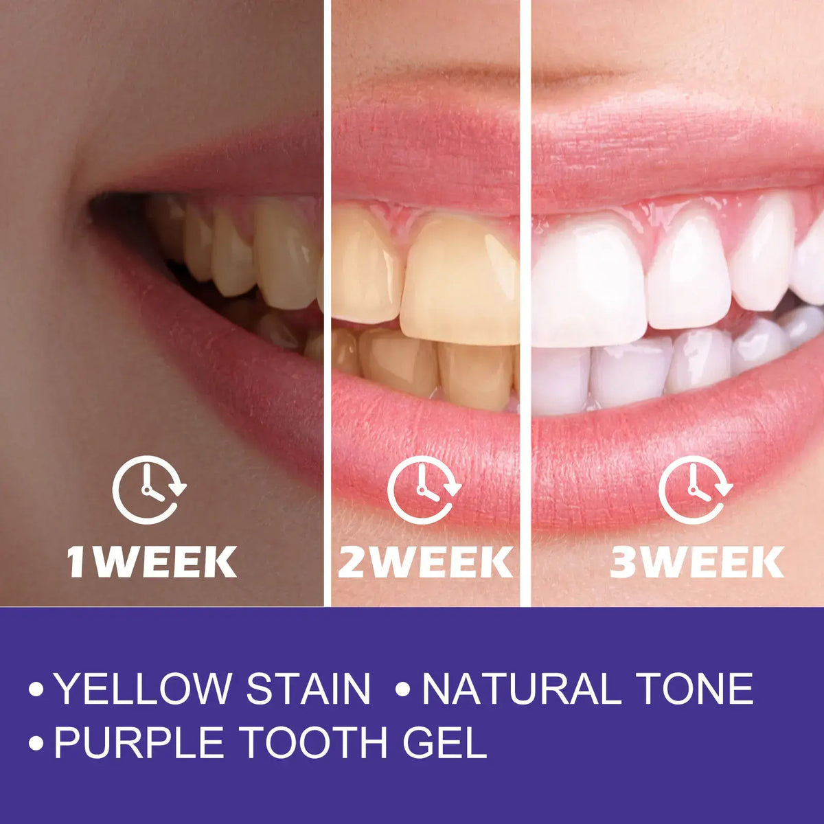 EELHOE 30ML Purple Whitening Toothpaste Teeth Stains Odors Removal Brighten Teeth  Gentle Gum Care Portable Travel Daily Use - Nexvibe