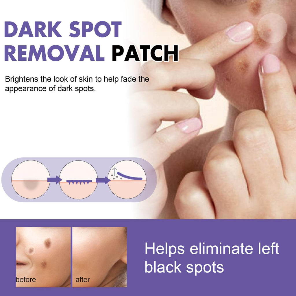 Effective Dark Spot Removal Patch for Brightening Your Skin - default title