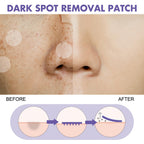 Effective Dark Spot Removal Patch for Brightening Your Skin - default title