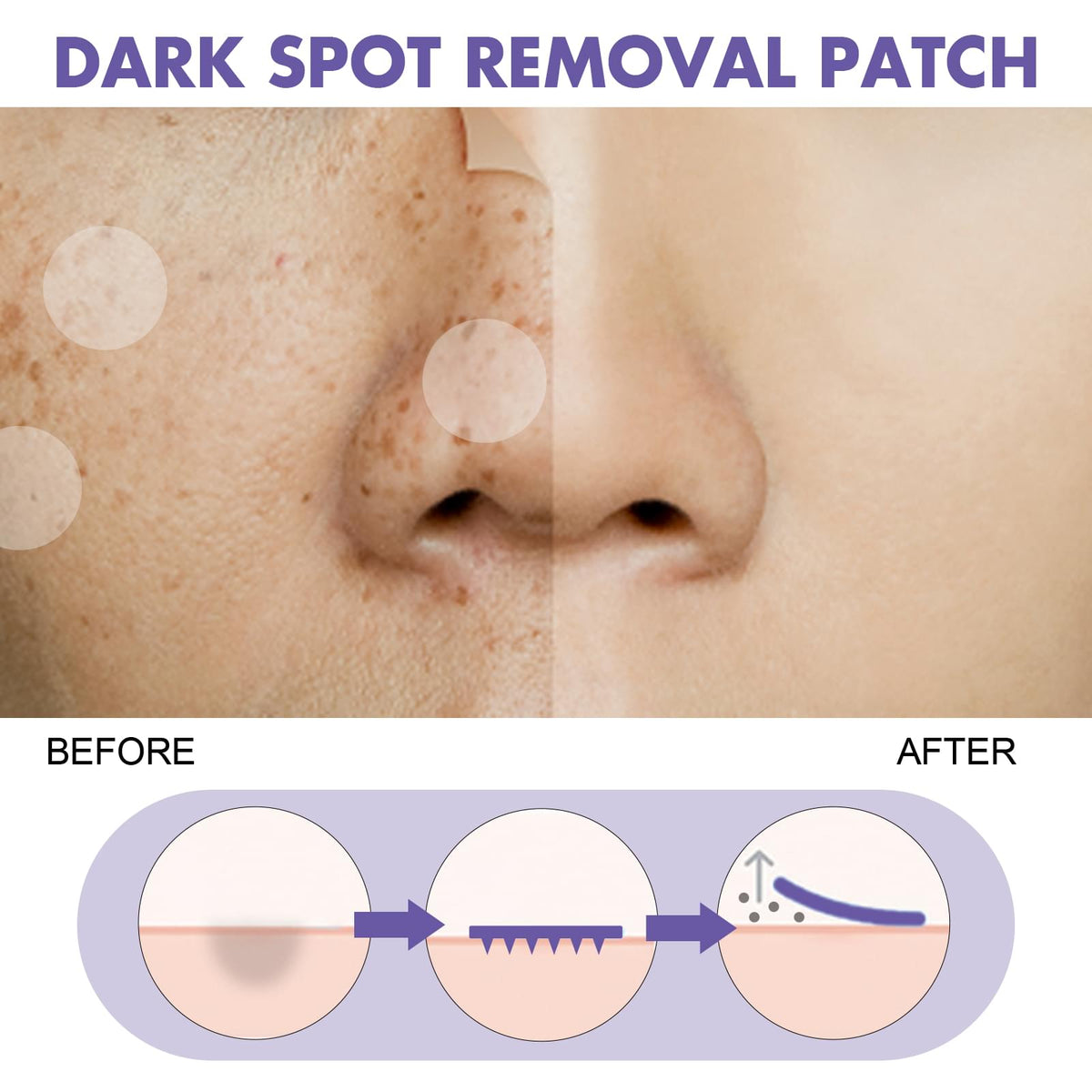 Effective Dark Spot Removal Patch for Brightening Your Skin - default title
