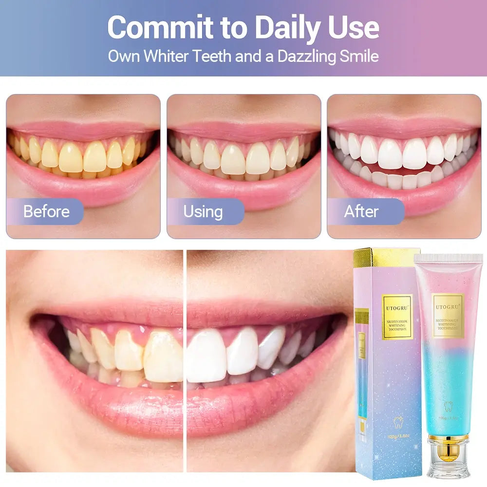 Niacinamide Whitening Toothpaste Refreshing Clean Teeth For Men And Women Fresh Breath Toothpaste To Remove Surface Stains - Nexvibe