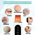 Ultrasonic Skin Scrubber Facial Peeling Machine Black Dots Acne Pore Deep Cleaning Ultrasonic Face Scrubber Blackhead Remover