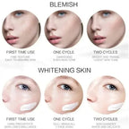 💎 EBUG Ultimate Dark Spot & Pigmentation Fading Set (5 Pcs)