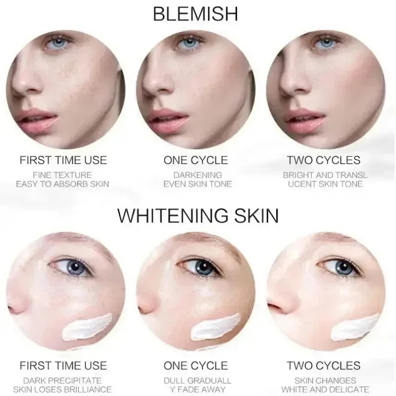 💎 EBUG Ultimate Dark Spot & Pigmentation Fading Set (5 Pcs)