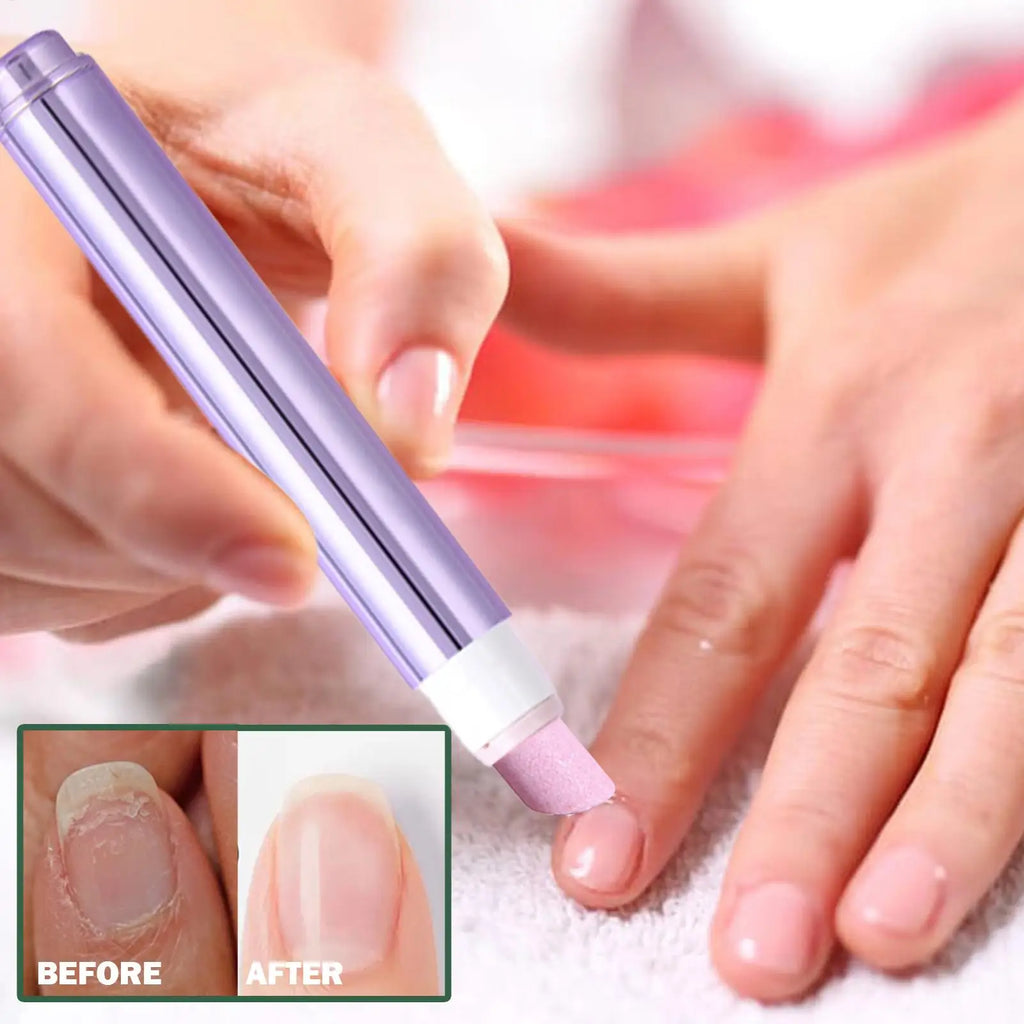 Nail Strengthener Damaged Nail Care Chip-resistant Cuticle Remover Pen for Nourishing Split Cracked Youth Weak Thin Men Elderly