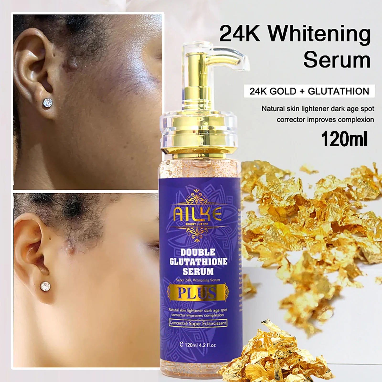 AILKE Dark Spot Remove Serum, Whitening Face Serum, Skin Brightening Discoloration Correcting Serum, Treatment For Face And Body