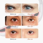 Red Eye Massager Under-Eye Glasses Massager Relieves Eye Fatigue Eyes Massage Glasses Eye Fatigue Relief Massager