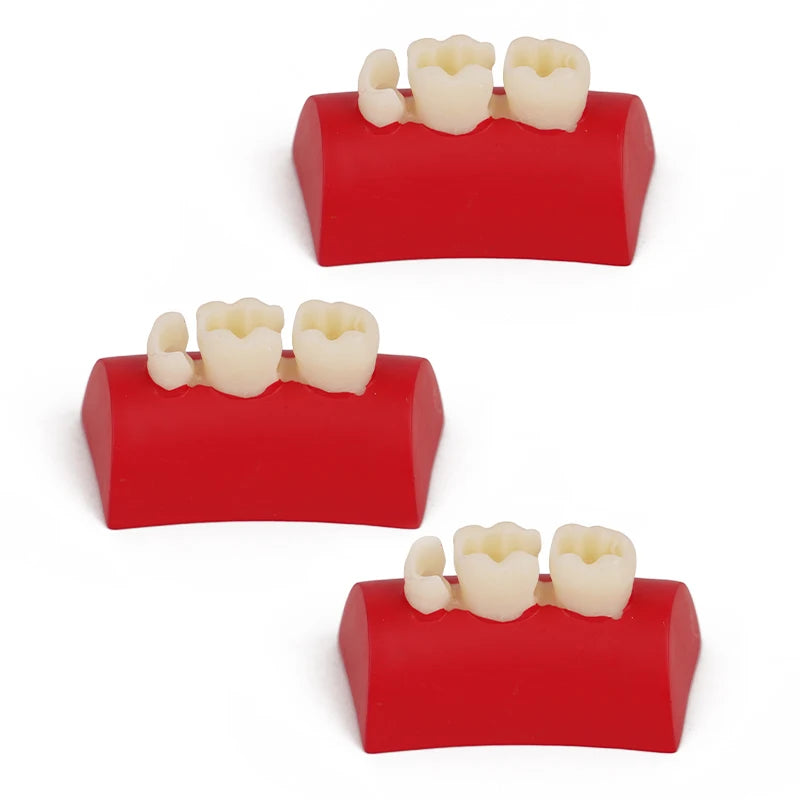 Dental Inlay Exercise Model Block Composite Resin Filling Practice Dentistry Oral Teeth Teaching Typodont Study Tool