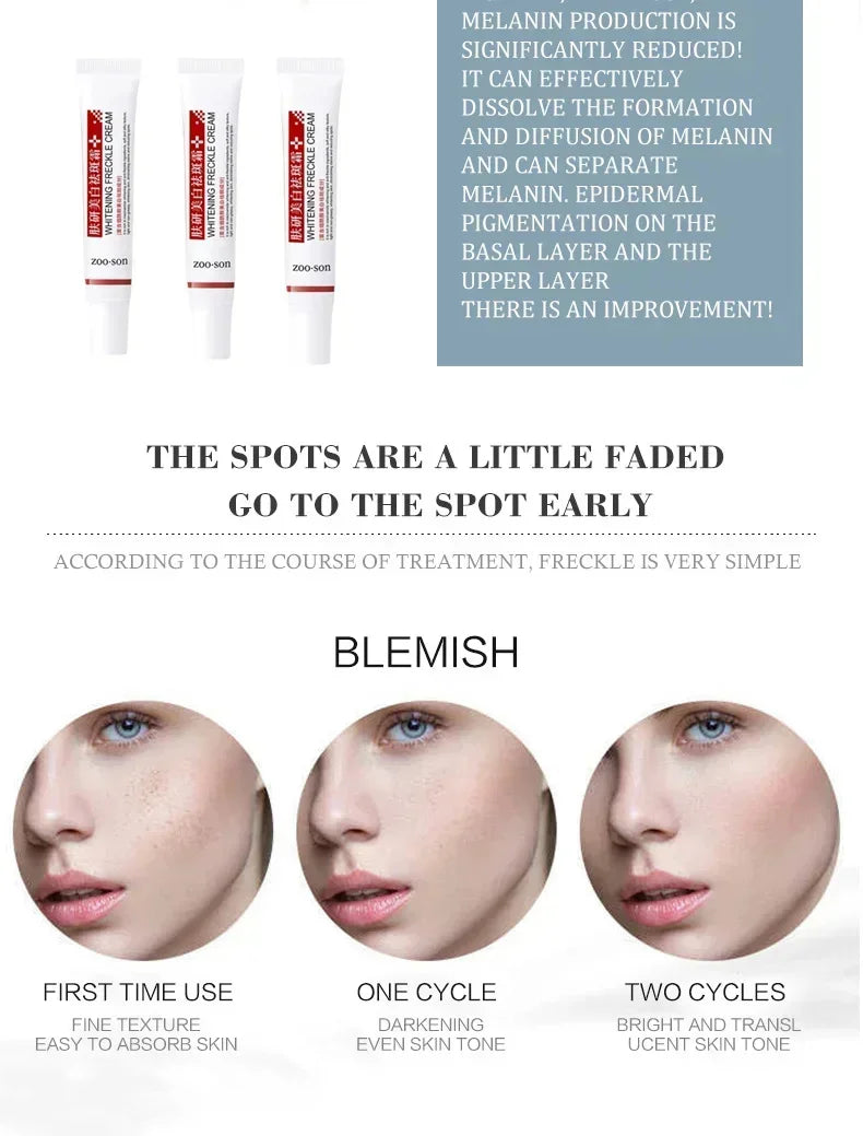 Freckle Removing Cream Women Face Quick Dark Spots Pigmentation Remove Whitening Cream Fade Melasma Brighten Cream for Dark Skin