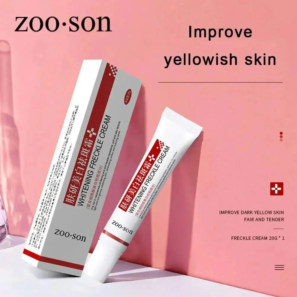 Freckle Removing Cream Women Face Quick Dark Spots Pigmentation Remove Whitening Cream Fade Melasma Brighten Cream for Dark Skin