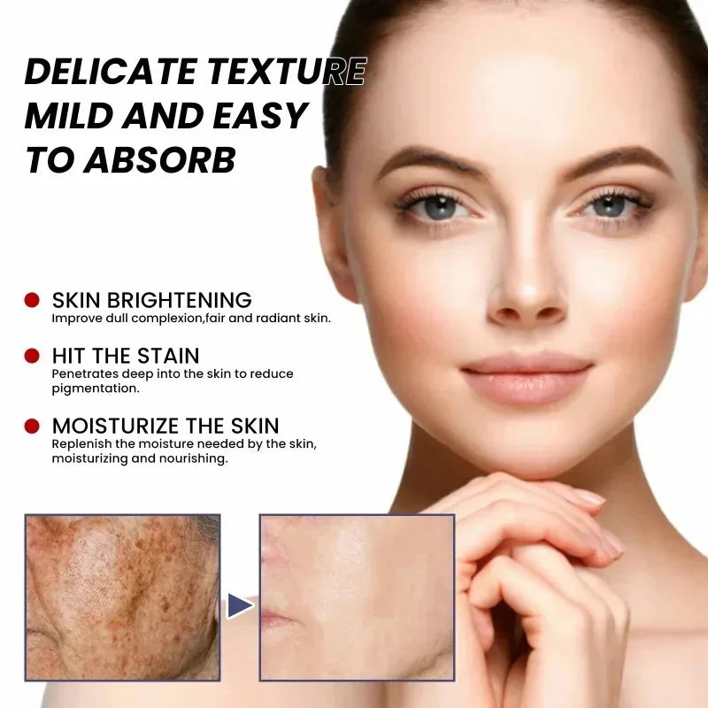 Freckle Removing Cream Women Face Quick Dark Spots Pigmentation Remove Whitening Cream Fade Melasma Brighten Cream for Dark Skin