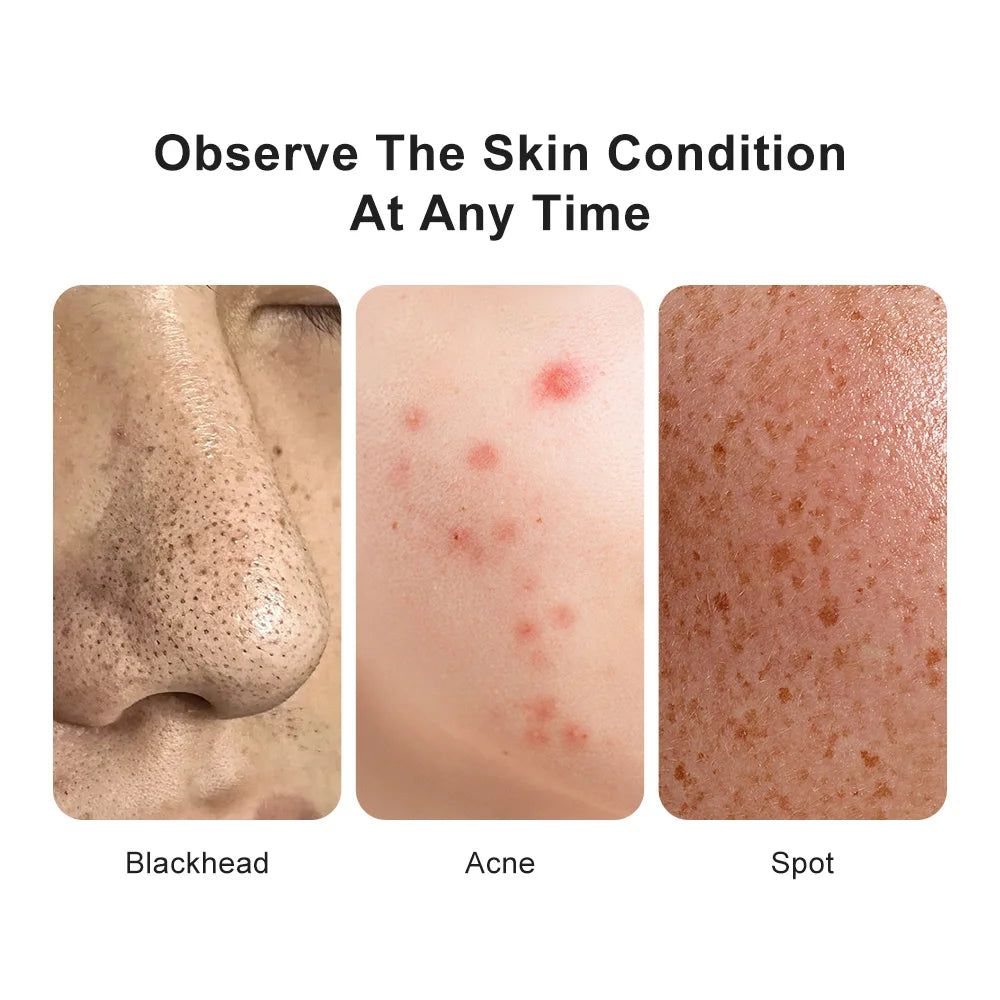 Digital Microscope Wireless Electron Dermatoscope Scalp Detection Pores Magnifier Facial Skin Analyzer Machine Professional