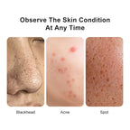 Digital Microscope Wireless Electron Dermatoscope Scalp Detection Pores Magnifier Facial Skin Analyzer Machine Professional