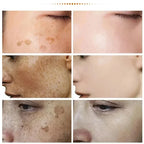 Freckle Removing Cream Women Face Quick Dark Spots Pigmentation Remove Whitening Cream Fade Melasma Brighten Cream for Dark Skin