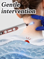 Plasma Pen for Warts Remover Mole Removal Pen Skin Tag Freckle Spot Care Electric Arc Beauty Tool
