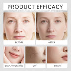 Niacinamide Microneedle Serum Facial Serum Kit 0.25mm Moisturizing Skin Nourishing Winter Skincare Face Roller Day Cream 30ml