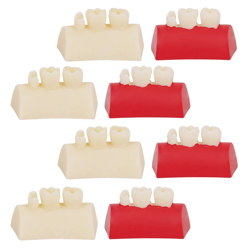Dental Inlay Exercise Model Block Composite Resin Filling Practice Dentistry Oral Teeth Teaching Typodont Study Tool