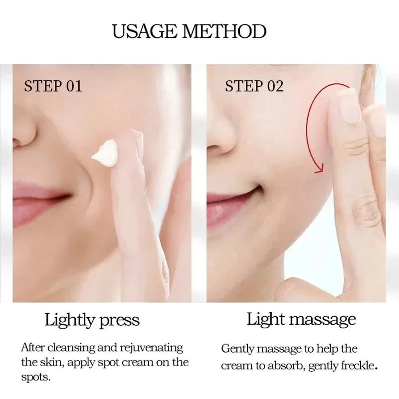 Freckle Removing Cream Women Face Quick Dark Spots Pigmentation Remove Whitening Cream Fade Melasma Brighten Cream for Dark Skin