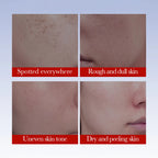 SADOER Anti Freckle Cream Face Brightening Creams Spot Removing Anti-aging Moisturizing Freckles Removal Facial Cream Skin Care