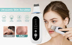 Ultrasonic Skin Scrubber Facial Peeling Machine Black Dots Acne Pore Deep Cleaning Ultrasonic Face Scrubber Blackhead Remover
