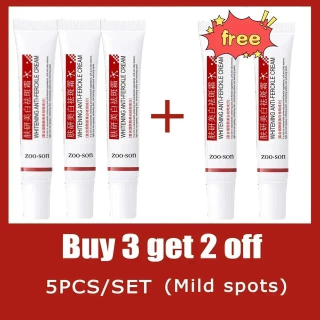 Freckle Removing Cream Women Face Quick Dark Spots Pigmentation Remove Whitening Cream Fade Melasma Brighten Cream for Dark Skin
