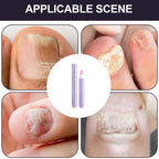 Nail Strengthener Damaged Nail Care Chip-resistant Cuticle Remover Pen for Nourishing Split Cracked Youth Weak Thin Men Elderly