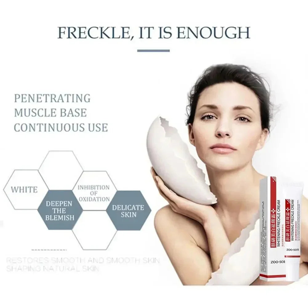 Freckle Removing Cream Women Face Quick Dark Spots Pigmentation Remove Whitening Cream Fade Melasma Brighten Cream for Dark Skin