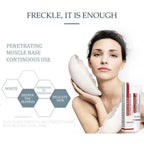 Freckle Removing Cream Women Face Quick Dark Spots Pigmentation Remove Whitening Cream Fade Melasma Brighten Cream for Dark Skin