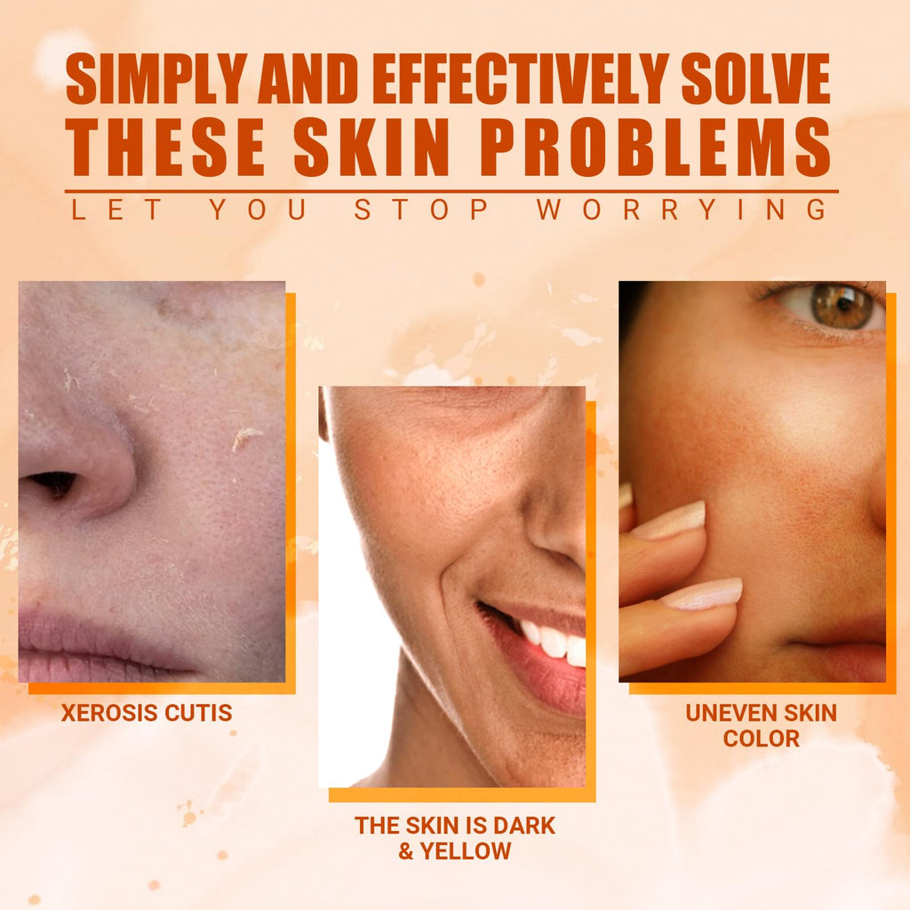 Vitamin C Moisturizing Spray Hydrates And Moisturizes Skin Lightening Acne Spots And Whitening Spray - default title