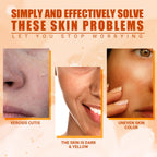 Vitamin C Moisturizing Spray Hydrates And Moisturizes Skin Lightening Acne Spots And Whitening Spray - default title