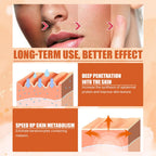 Vitamin C Moisturizing Spray Hydrates And Moisturizes Skin Lightening Acne Spots And Whitening Spray - default title